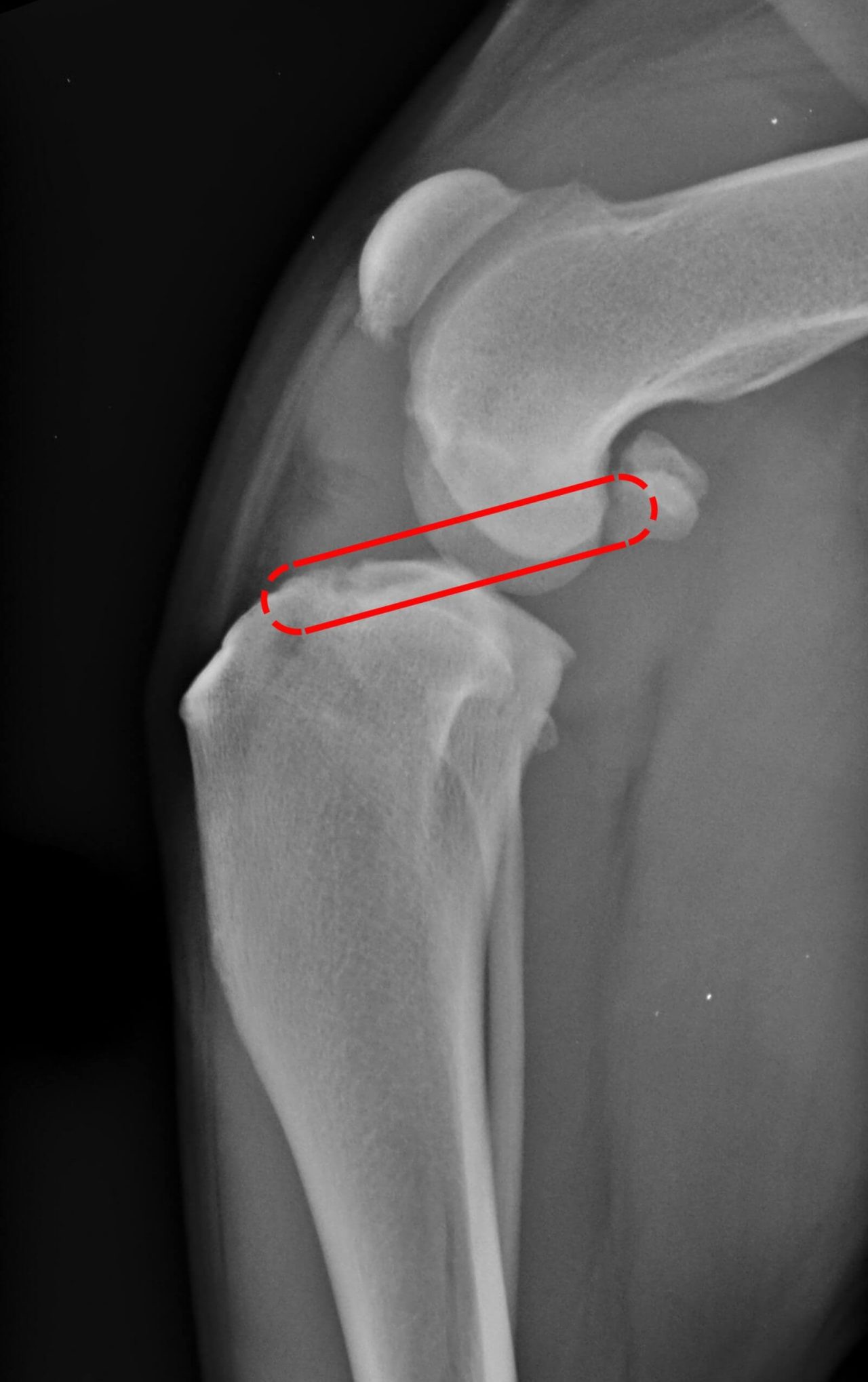 Cruciate Ligament Repair Surgery for Dogs Vets of Geelong